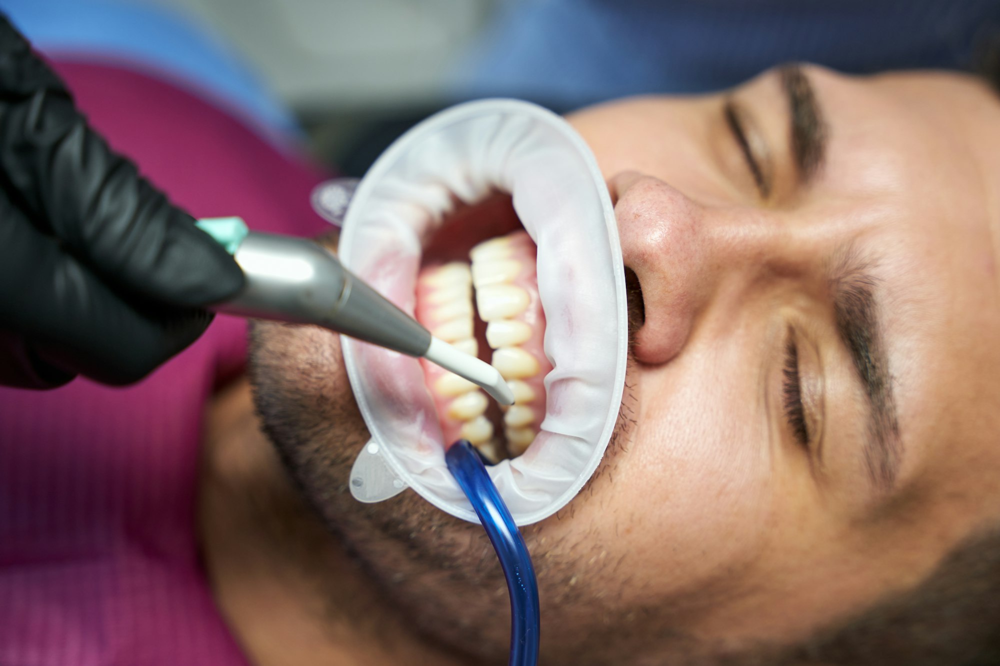 Patient of dental clinic with closed eyes and dental dam