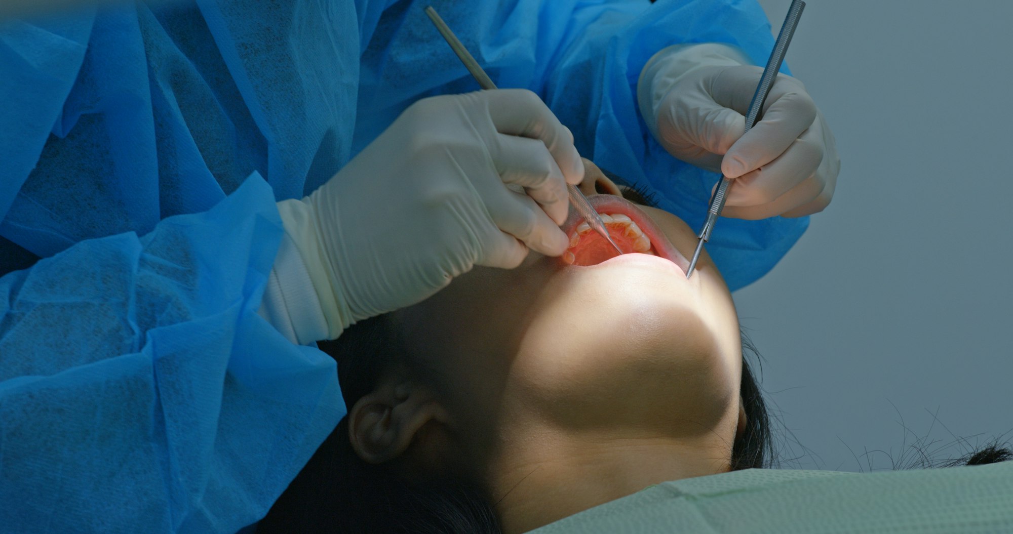 Woman under dental check up in clinic